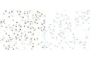 Immunocytochemistry (ICC) image for anti-gamma Histone Variant H2AX (GAMMA-H2AX) (Ser140) antibody (ABIN7449557) (gamma H2AX 抗体  (Ser140))