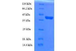 SDS-PAGE (SDS) image for Ropporin, Rhophilin Associated Protein 1B (ROPN1B) (AA 1-120) protein (GST tag) (ABIN5710266) (ROPN1B Protein (AA 1-120) (GST tag))