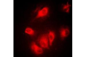 Immunofluorescent analysis of Aurora A staining in MCF7 cells. (Aurora A 抗体  (C-Term))