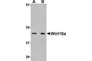 Western blot analysis of Wnt10a in RAW264. (WNT10A 抗体  (C-Term))