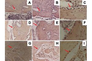 Immunohistochemistry (IHC) image for anti-Tumor Necrosis Factor (Ligand) Superfamily, Member 11 (TNFSF11) (AA 74-308) antibody (ABIN5611143)