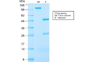 SDS-PAGE Analysis Purified IGF-1 Rabbit Recombinant Monoclonal Anitbody (IGF1/2872R). (Recombinant IGF1 抗体)