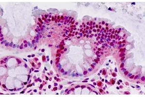 Human Colon: Formalin-Fixed, Paraffin-Embedded (FFPE) (MAT2A 抗体  (AA 27-55))