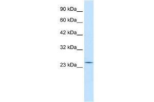 WB Suggested Anti-RGS13 Antibody Titration:  0. (RGS13 抗体  (Middle Region))