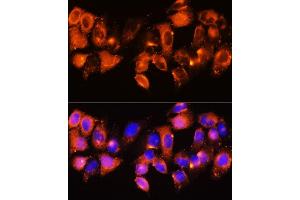 Immunofluorescence analysis of HeLa cells using IGFBP5 antibody (ABIN6130485, ABIN6142257, ABIN6142259 and ABIN6216084) at dilution of 1:100. (IGFBP5 抗体  (AA 68-167))