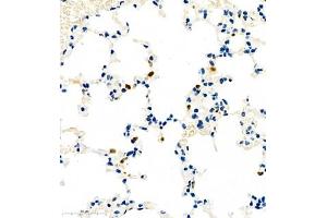 Immunohistochemistry (Paraffin-embedded Sections) (IHC (p)) image for anti-Chemokine (C-C Motif) Ligand 3 (CCL3) antibody (ABIN7073450)