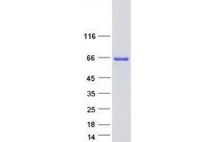 Validation with Western Blot
