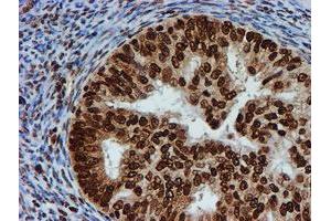 Image no. 1 for anti-Fragile X Mental Retardation 1 (FMR1) antibody (ABIN1498287) (FMR1 抗体)