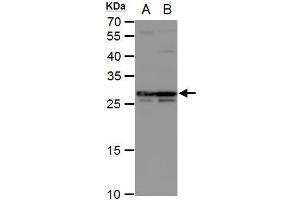 Western Blotting (WB) image for anti-Deoxycytidine Kinase (DCK) (Center) antibody (ABIN2856517)