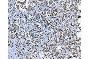IHC analysis of PTRF/CAVIN1 using anti-PTRF/CAVIN1 antibody (ABIN7601817). (PTRF 抗体  (AA 47-390))