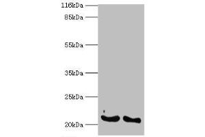 Western blot analysis of (1) A549 whole cell lysates and (2) mouse lung tissue, using IFNA14 antibody (2 μg/ml) and goat anti-rabbit polyclonal secondary antibody (1/10000 dilution). (IFNa14 抗体  (AA 24-189))
