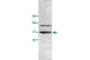 Western blot analysis of human fetal liver lysate with HINT2 polyclonal antibody  at 1 : 500 dilution. (HINT2 抗体  (AA 59-163))