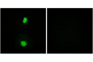 Immunofluorescence analysis of HeLa cells, using TIP60 (Ab-86) Antibody. (KAT5 抗体  (AA 52-101))
