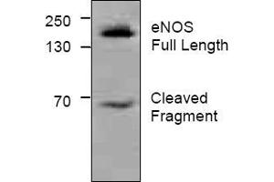 Western Blot analysis of eNOS in Jurkat Cell Lysate using AP31282PU-N eNOS antibody.