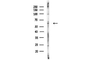 Western blot analysis of lysates from COLO205 cells(UV,30 min treatment), using p62Dok Antibody at 1/1000 dilution.