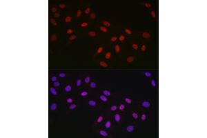 Immunofluorescence analysis of U2OS cells using CTBP2 Rabbit mAb (ABIN7265979) at dilution of 1:100 (40x lens). (CTBP2 抗体)