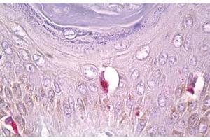 Anti-PLCG1 antibody IHC staining of human skin, Langerhans cell. (Phospholipase C gamma 1 抗体  (AA 751-800))