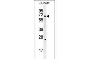 GCLC Antibody (N-term) (ABIN655884 and ABIN2845285) western blot analysis in Jurkat cell line lysates (35 μg/lane). (GCLC 抗体  (N-Term))