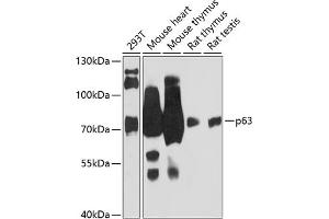 Western blot analysis of extracts of various cell lines, using p63 antibody (ABIN6133473, ABIN6149426, ABIN6149429 and ABIN6216798) at 1:3000 dilution. (p63 抗体  (AA 1-160))