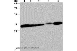 Western blot analysis of HUVEC and 293T cell, mouse bladder, human placenta and mouse kidney tissue, using CLDN23 Polyclonal Antibody at dilution of 1:200 (Claudin 23 抗体)