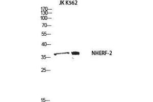 Western Blot (WB) analysis of JK K562 using NHERF-2 antibody. (SLC9A3R2 抗体)