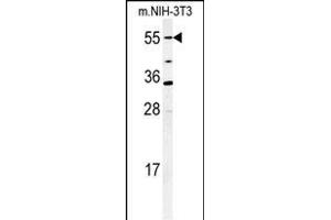 Western blot analysis of CYP26A1 Antibody (C-term) (ABIN650717 and ABIN2837925) in mouse NIH-3T3 cell lysates (35 μg/lane). (CYP26A1 抗体  (C-Term))