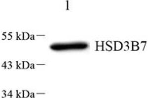 Western blot analysis of HSD3B7 (ABIN7074263) at dilution of 1: 1000,Lane 1: HeLa cell lysate (HSD3B7 抗体)