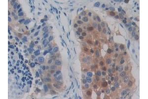 Immunohistochemistry (IHC) image for anti-Doublecortin-Like Kinase 1 (DCLK1) (AA 390-647) antibody (ABIN7436015)