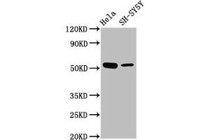 Western Blot Positive WB detected in: Hela whole cell lysate, SH-SY5Y whole cell lysate All lanes: MEX3A antibody at 4. (MEX3A 抗体  (AA 416-466))