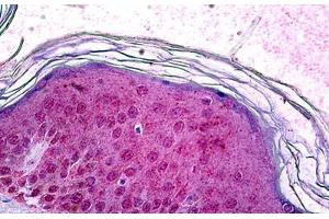 Human Skin: Formalin-Fixed, Paraffin-Embedded (FFPE) (SOX10 抗体)