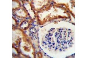 Immunohistochemistry (Paraffin-embedded Sections) (IHC (p)) image for anti-DnaJ (Hsp40) Homolog, Subfamily C, Member 22 (DNAJC22) (AA 250-280), (C-Term) antibody (ABIN951948)