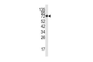 Western blot analysis of anti-PD3 Antibody (Center) (ABIN1538324 and ABIN2841988) in mouse lung tissue lysates (35 μg/lane). (AMPD3 抗体  (AA 325-356))
