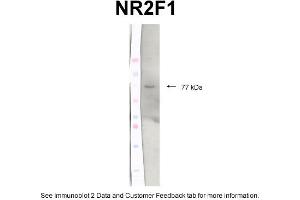 Western Blotting (WB) image for anti-Nuclear Receptor Subfamily 2, Group F, Member 1 (NR2F1) (C-Term) antibody (ABIN2783186)