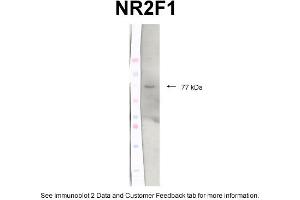 WB Suggested Anti-N32F1 Antibody Titration: 2 ug/mlPositive Control: Protein extracts, Chicken brain tissue (NR2F1 抗体  (C-Term))