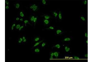 Image no. 3 for anti-Tripartite Motif Containing 24 (TRIM24) (AA 432-569) antibody (ABIN599067) (TRIM24 抗体  (AA 432-569))