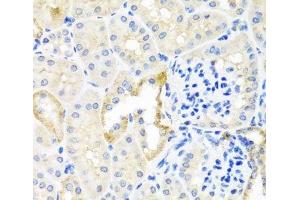 Immunohistochemistry of paraffin-embedded Mouse kidney using TDGF1 Polyclonal Antibody at dilution of 1:100 (40x lens). (TDGF1 抗体)