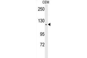 Western Blotting (WB) image for anti-threonine Synthase-Like 2 (THNSL2) antibody (ABIN3002296) (THNSL2 抗体)