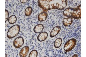 Immunoperoxidase of monoclonal antibody to PNPLA6 on formalin-fixed paraffin-embedded human small Intestine. (PNPLA6 抗体  (AA 1229-1327))