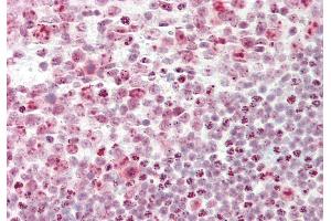 Immunohistochemistry (IHC) image for anti-Cleavage Stimulation Factor, 3' Pre-RNA, Subunit 3, 77kDa (CSTF3) (N-Term) antibody (ABIN2778767)