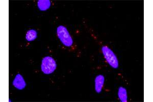 Proximity Ligation Analysis of protein-protein interactions between MAP2K3 and MAP2K6. (MAP2K6 抗体  (AA 231-334))