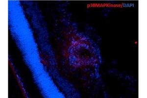 Immunohistochemistry analysis using Mouse Anti-p38 MAPK Monoclonal Antibody, Clone 9F12 (ABIN361679 and ABIN361680). (MAPK14 抗体)