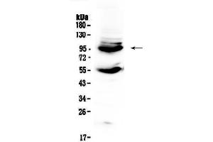 Western blot analysis of CD105 using anti-CD105 antibody . (Endoglin 抗体  (AA 27-226))