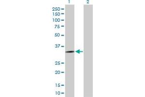 Western Blot analysis of HOXD13 expression in transfected 293T cell line by HOXD13 MaxPab polyclonal antibody. (Homeobox D13 抗体  (AA 1-343))