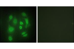 Immunofluorescence analysis of HepG2 cells, using hnRNP Q antibody. (SYNCRIP 抗体)