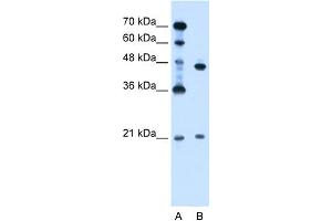 WB Suggested Anti-UBE2E2 Antibody Titration:  0. (UBE2E2 抗体  (N-Term))