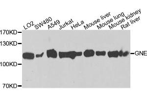 Western blot analysis of extracts of various cells, using GNE antibody. (GNE 抗体)