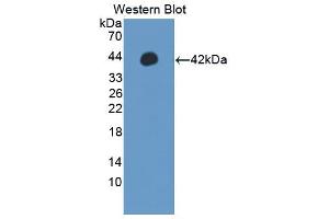 Western blot analysis of the recombinant protein. (IRF5 抗体  (AA 136-475))