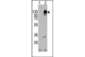 Image no. 1 for anti-Platelet Derived Growth Factor Receptor alpha (PDGFRA) (Tyr754) antibody (ABIN359914) (PDGFRA 抗体  (Tyr754))