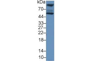 Detection of HEXa in Human HepG2 cell lysate using Polyclonal Antibody to Hexosaminidase A Alpha (HEXa)
