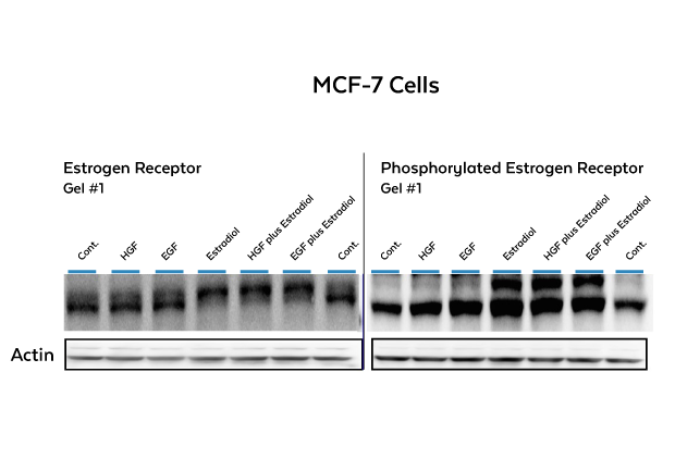 Western blot electrophoretic mobility shift assay (EMSA): estradiol-stimulated phosphorylation of estrogen receptors on MCF-7 breast cancer cells